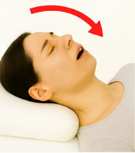 後頭部への体圧で頭が前傾し、気道が狭くなる様子