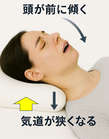 後頭部への体圧で頭が前傾し、気道が狭くなる様子